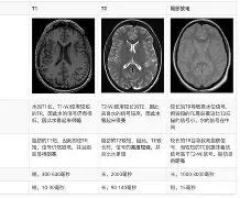 米兰真人-T1逆转TSM，Bwipo高光表现